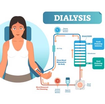 Dialysis Treatment