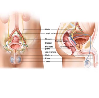 Prostate Treatment