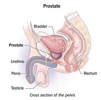 Prostate Treatment